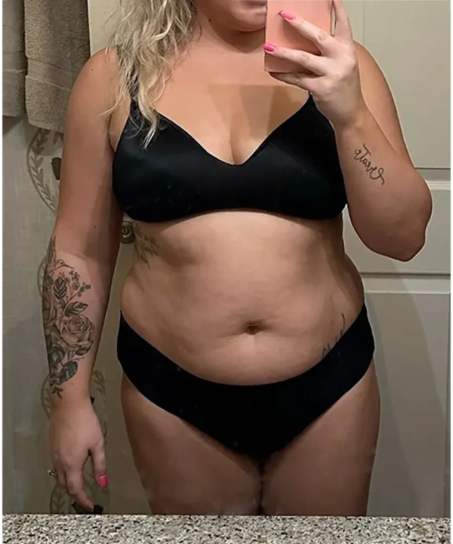 Featured Eden member before treatment